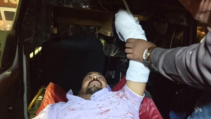 राहुल अंधारेचा हात तोडणारे दोन सराईत समोर, पोलिसांच्या हातावर तुरी देऊन फरार