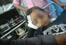 जामखेडमध्ये भटक्या कुत्र्यांचा कहर! पिसाळलेल्या कुत्र्याच्या हल्ल्यात दीड वर्षाच्या चिमुकलीचा डोळा निकामी; तिघे गंभीर जखमी बोराटे वस्ती हादरली, चिमुकलीवर पुण्यात शस्त्रक्रिया, उपचारासाठी १० लाखांचा खर्च